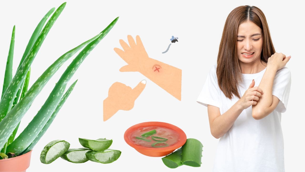 Aloe Vera, a Natural Remedy for Mosquito Bites