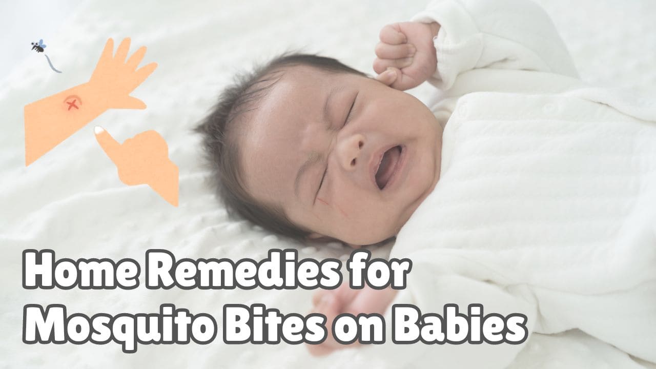 Home remedies for mosquito bites on babies