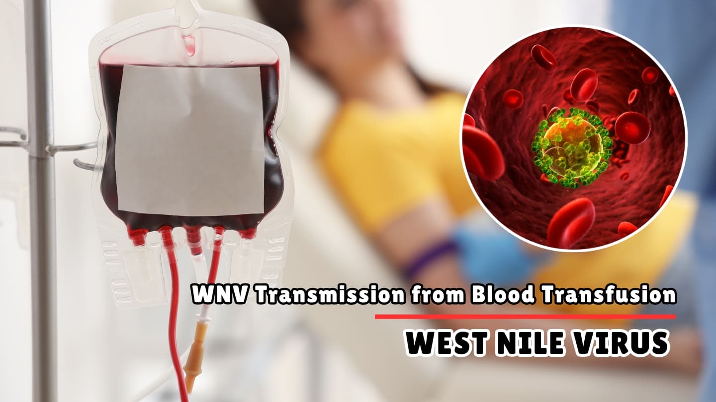 Can You Get West Nile Virus from a Blood Transfusion