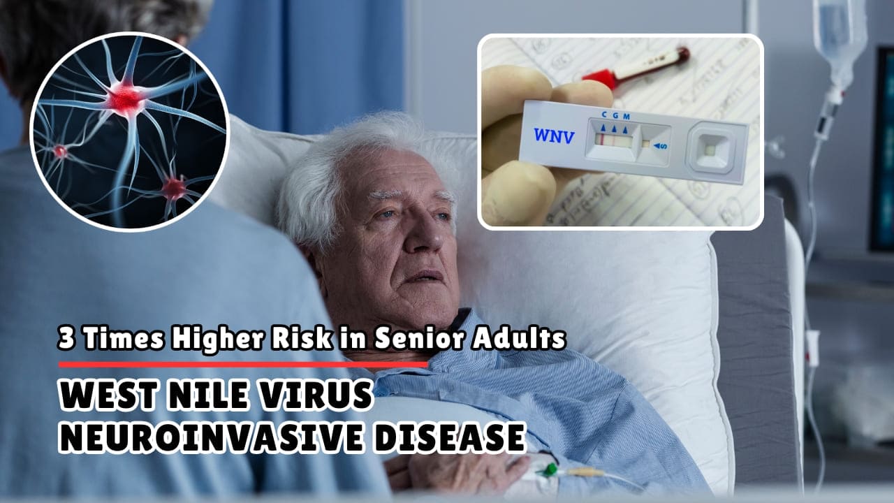West Nile Virus in Elderly Why Age 65+ Triples Neuroinvasive Risk